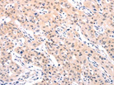 TRAF2 Antibody