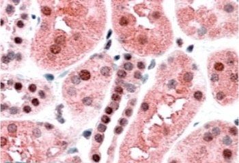 TRAF2 Antibody