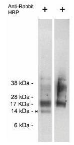 Rabbit anti Human Trag 3 (Taxol-resistant-associated protein 3) Antibody