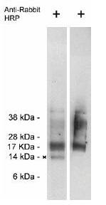 Rabbit anti Human Trag 3 (Taxol-resistant-associated protein 3) Antibody