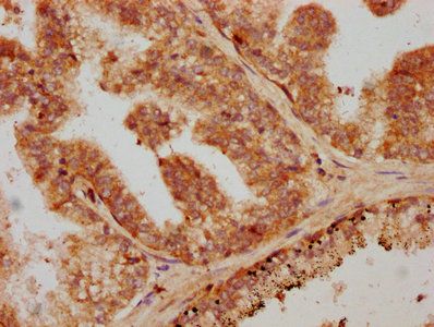 TGFB1 Antibody