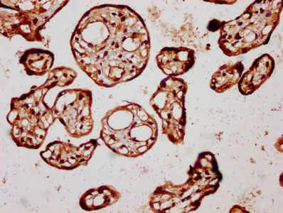 TGFB3 Antibody