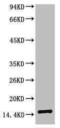 TTR Antibody