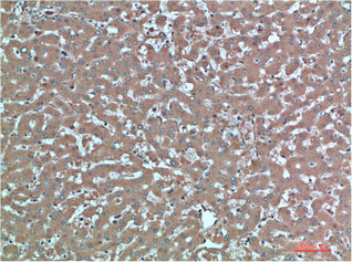 TTR Antibody