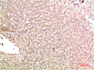 TTR Antibody