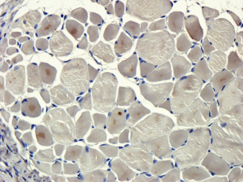 Transthyretin Mouse Monoclonal Antibody