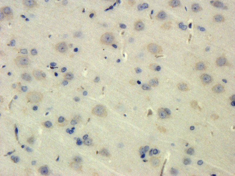 Transthyretin Mouse Monoclonal Antibody