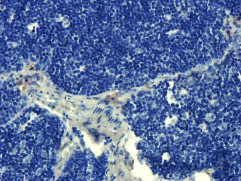 Transthyretin Mouse Monoclonal Antibody