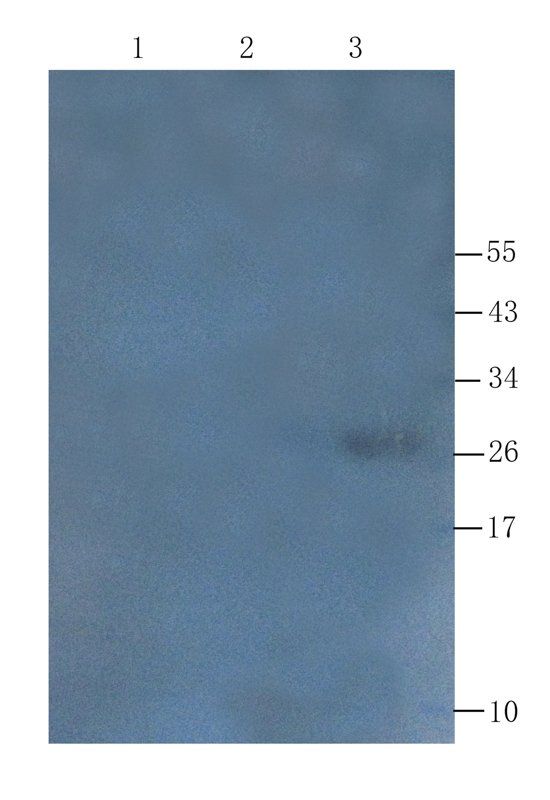 Transthyretin Mouse Monoclonal Antibody