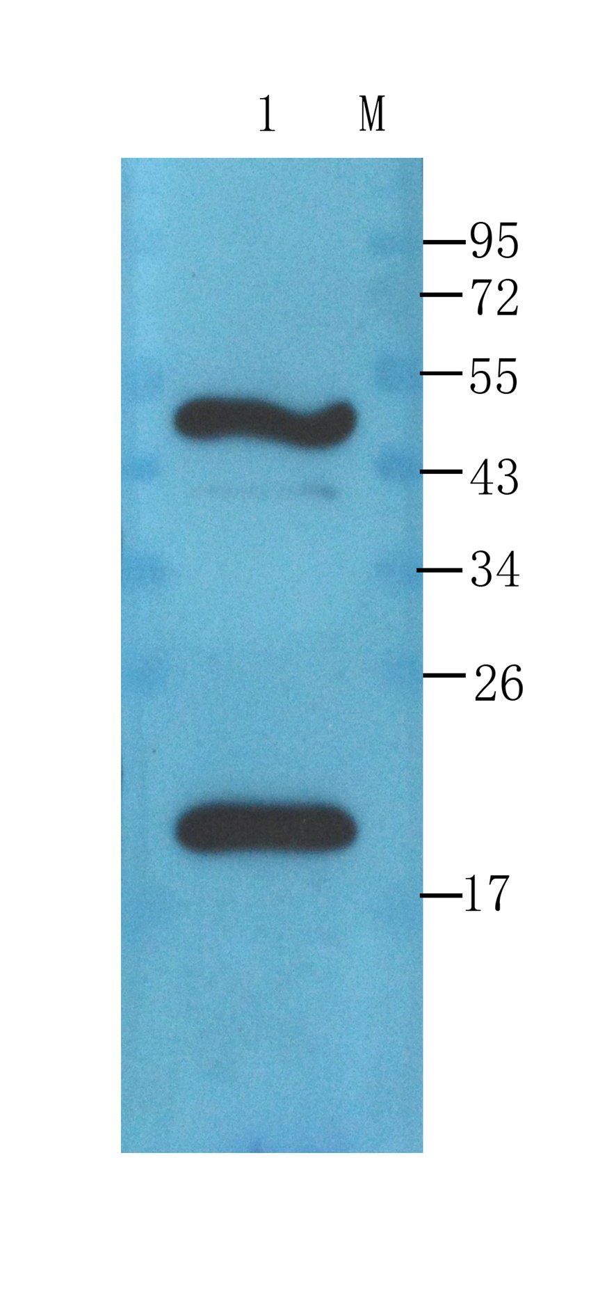 Transthyretin Mouse Monoclonal Antibody