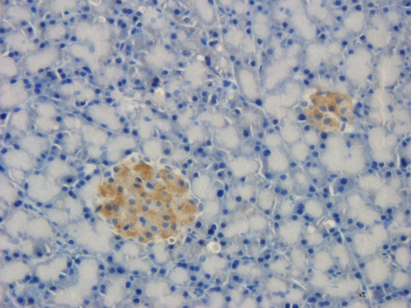 TREM2 Rabbit Polyclonal Antibody