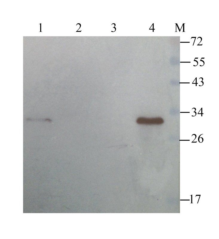 TREM2 Rabbit Polyclonal Antibody