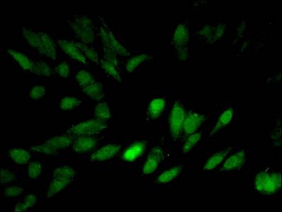 HIST1H3A Antibody