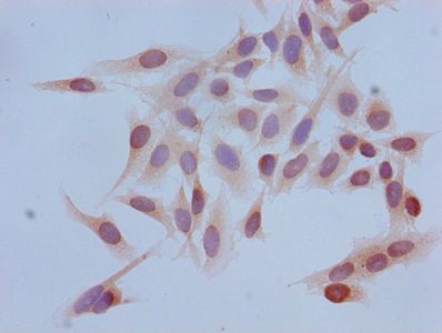 HIST1H3A Antibody