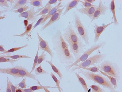 HIST1H3A Antibody