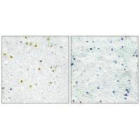 TRIM24 Antibody
