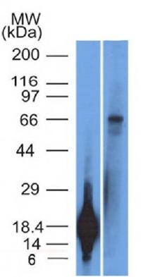 TRIM29 Antibody