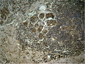 HIST1H3A Antibody