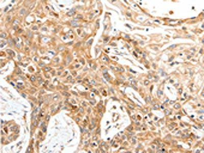 TPM2 Antibody