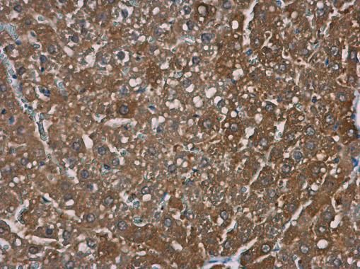 TRPM2 Rabbit Polyclonal Antibody