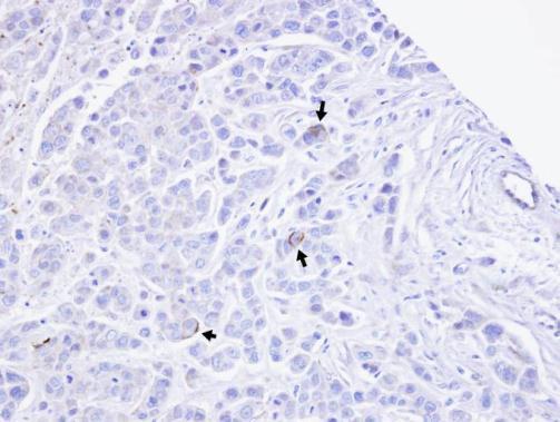 TRPM2 Rabbit Polyclonal Antibody