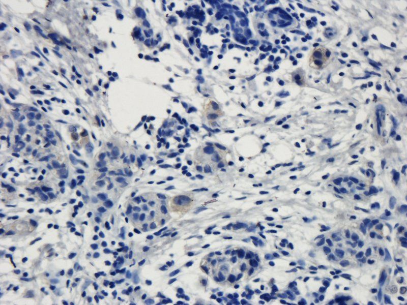TRPV1 Rabbit Polyclonal Antibody