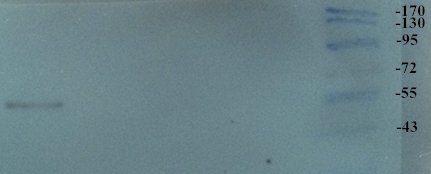 TRPV1 Rabbit Polyclonal Antibody