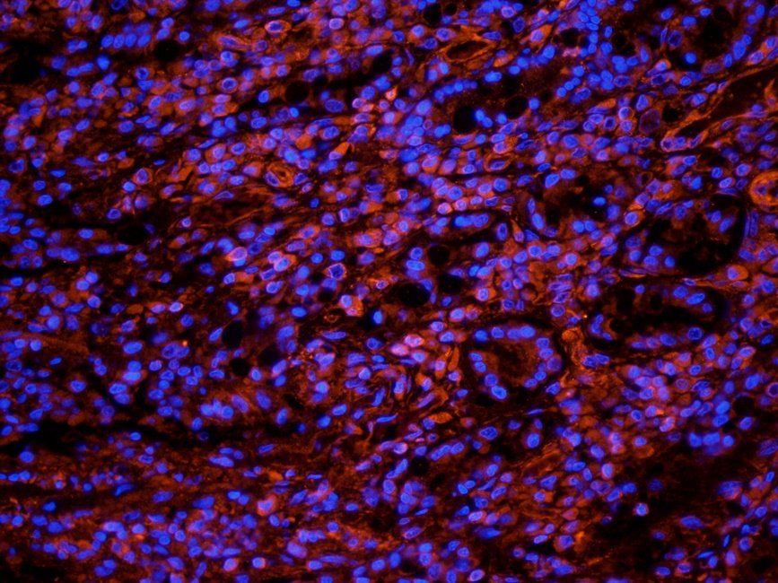TRPV5 Rabbit Polyclonal Antibody