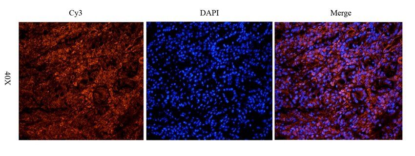 TRPV5 Rabbit Polyclonal Antibody