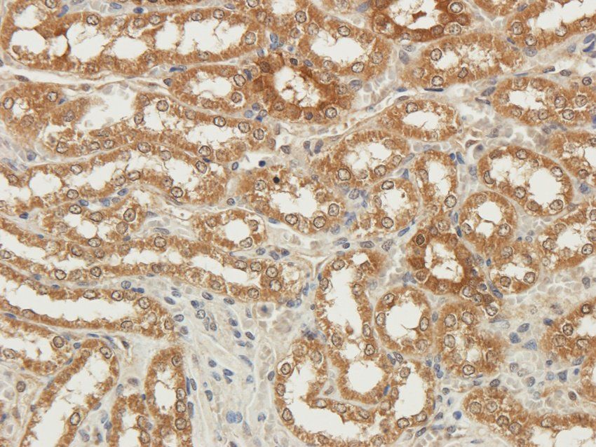 TRPV5 Rabbit Polyclonal Antibody