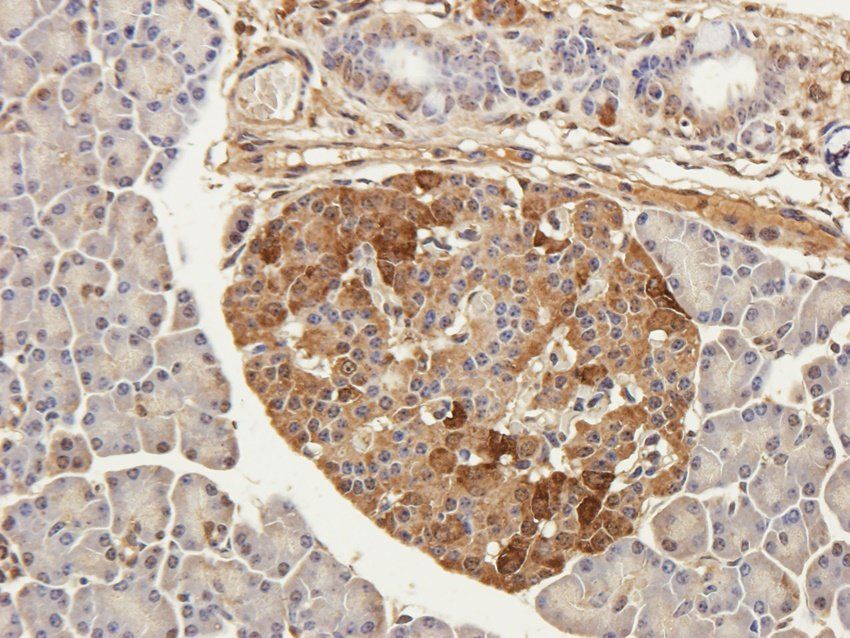 TRPV5 Rabbit Polyclonal Antibody