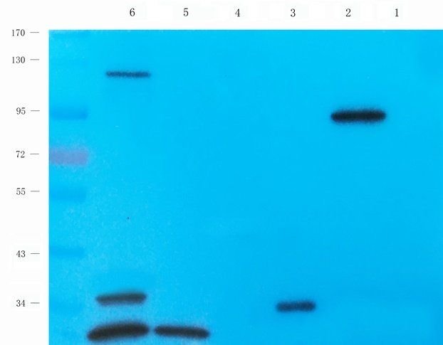 TRPV5 Rabbit Polyclonal Antibody