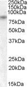 TRPV5 Antibody