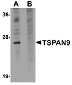TSPAN9 Rabbit Polyclonal Antibody