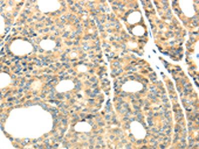 TTBK2 Antibody