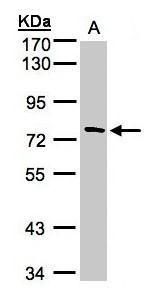 TTC30A Rabbit Polyclonal Antibody