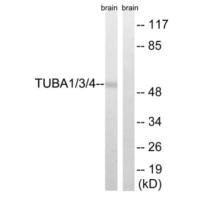 TUBA1A/TUBA1B/TUBA1C/TUBA3C/TUBA3E Antibody