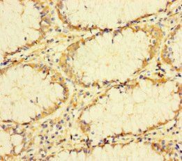 TUBA1B Antibody