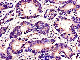 TUBA4A Antibody