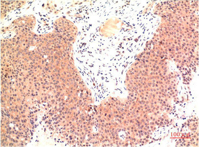 TUBE1 Antibody