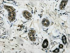 TUBB3 Antibody