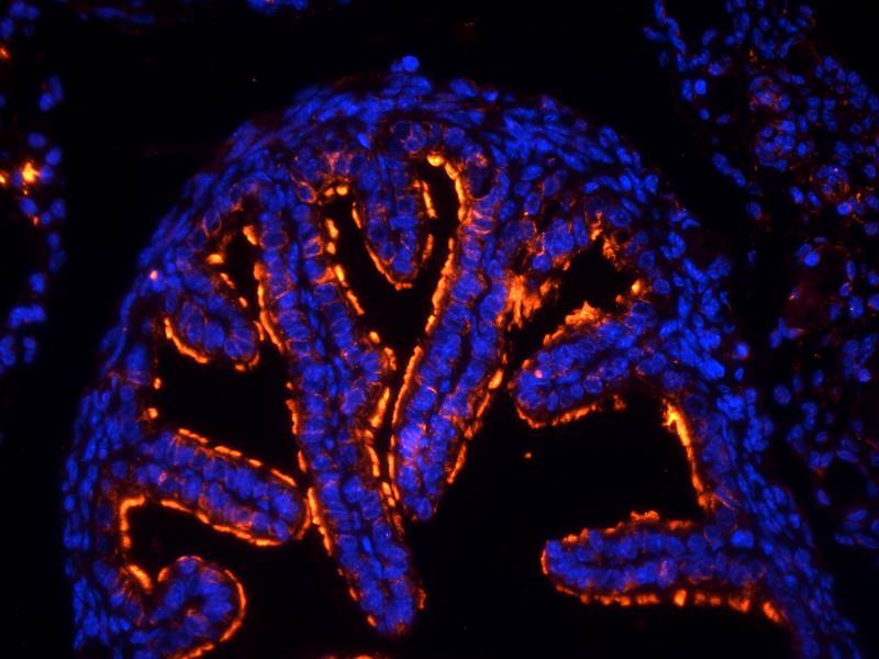 Tubulin beta 3 Rabbit Polyclonal Antibody