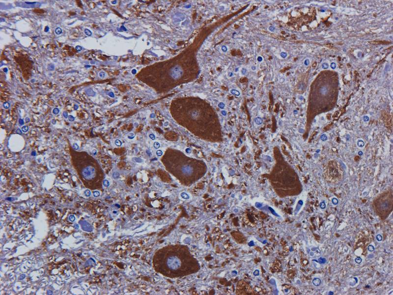 Tubulin beta 3 Rabbit Polyclonal Antibody