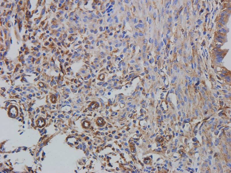 Tubulin beta 3 Rabbit Polyclonal Antibody