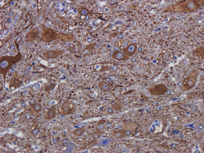 Tubulin beta 3 Rabbit Polyclonal Antibody