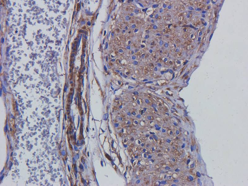 Tubulin beta 3 Rabbit Polyclonal Antibody