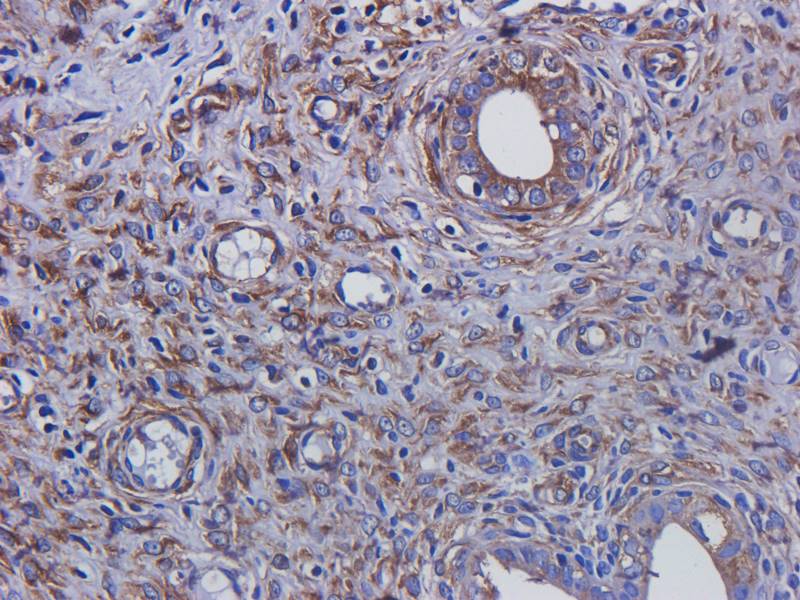 Tubulin beta 3 Rabbit Polyclonal Antibody