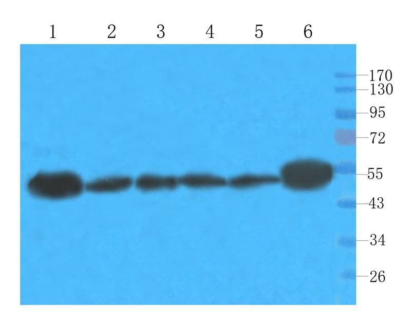 Tubulin beta 3 Rabbit Polyclonal Antibody
