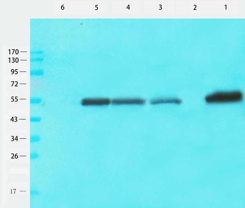 Tubulin beta 3 Rabbit Polyclonal Antibody