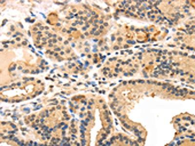 TUSC5 Antibody